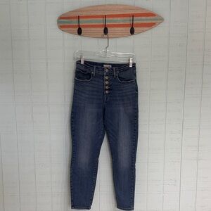 Lucky Brand Button Fly Ankle Skinny Jeans